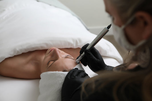 Why Microneedling Has Become One of the Most Requested Skin Treatments in Kelowna
