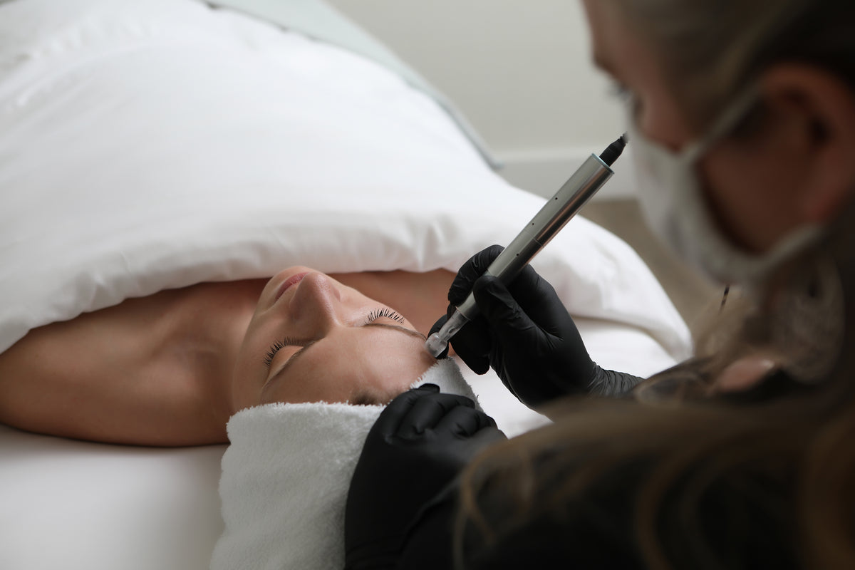 microneedling in Kelowna